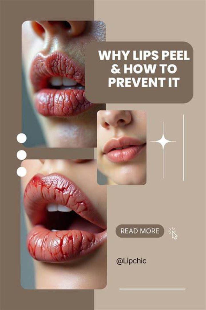 Why do I peel my lips?