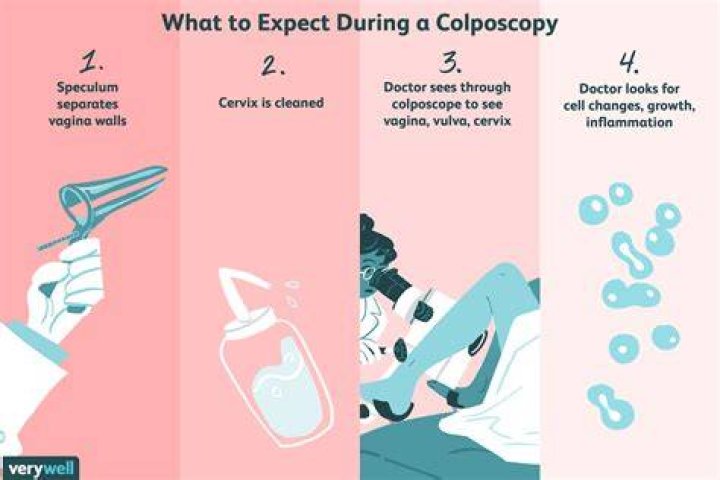 Why do I smell after a colposcopy?