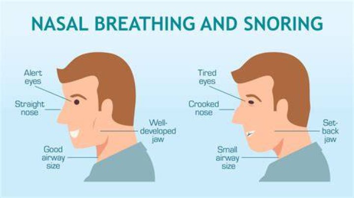 Why do I snore through my nose?