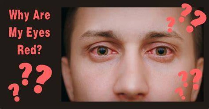 Why do I turn red around my crush?