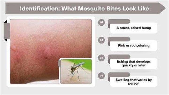 Why do mosquito bites get so big?
