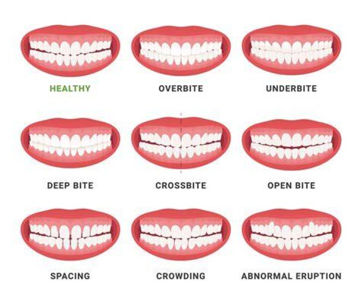 Why do my teeth pop when I push on them?