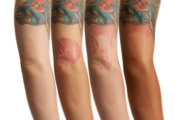 Why do new tattoos smell?