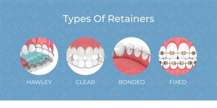 Why do people wear metal retainers?