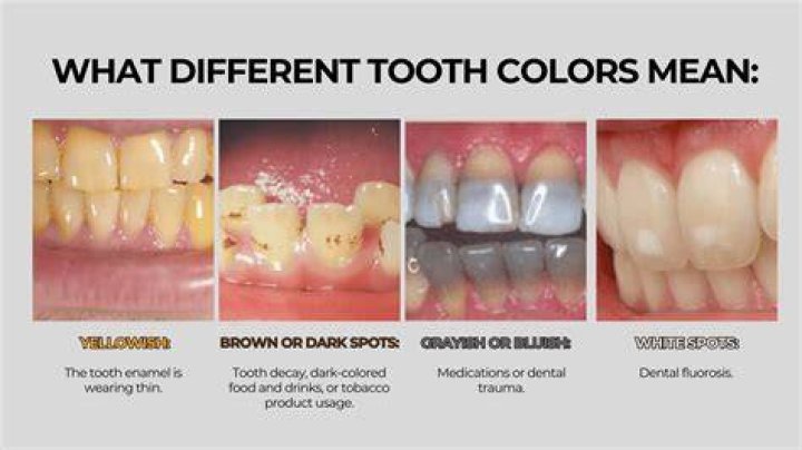 Why do teeth turn grey with age?