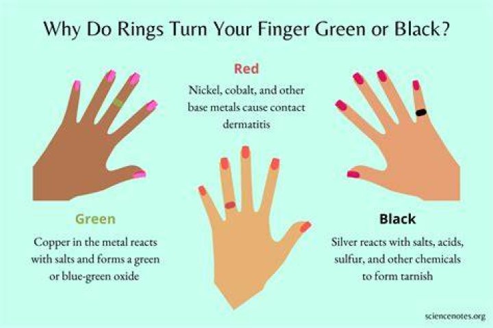 Why do the rings turn orange?