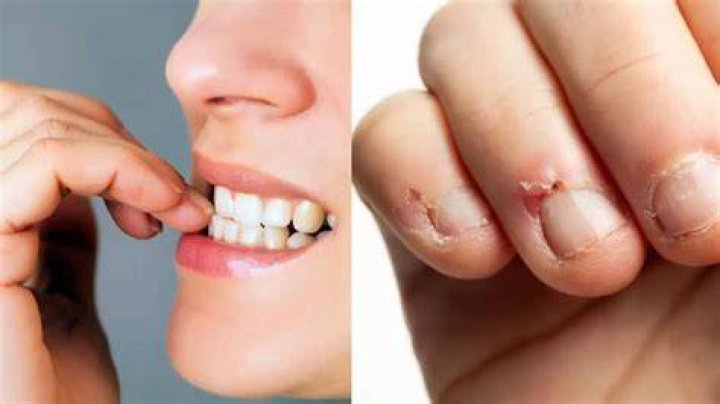 Why do we bite our nails?