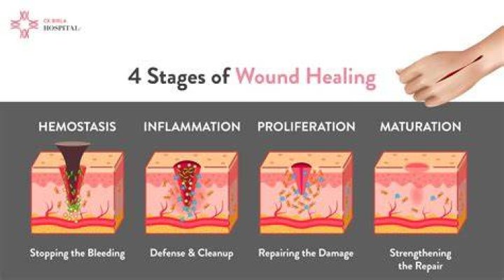 Why do wounds hurt while healing?
