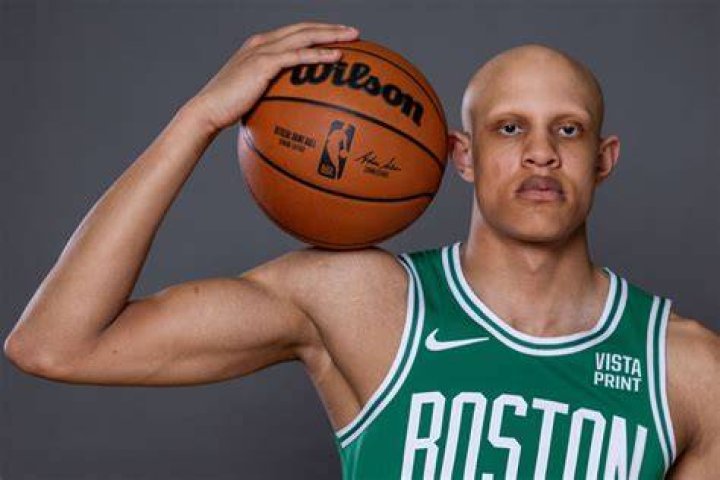 Why does Charlie Villanueva have no hair?