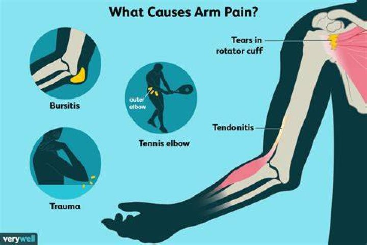 Why does my arm hurt from my shoulder to my hand?