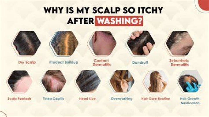 Why does my head scratch so much?