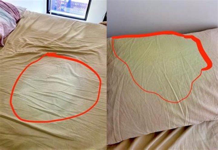 Why does my husband's sweat stain the sheets?