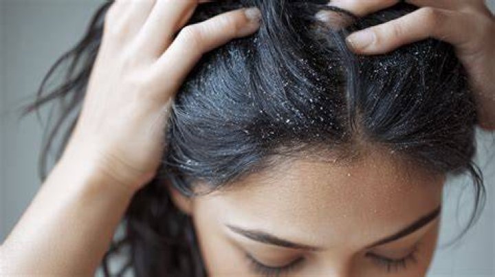 Why does my scalp itch at night?