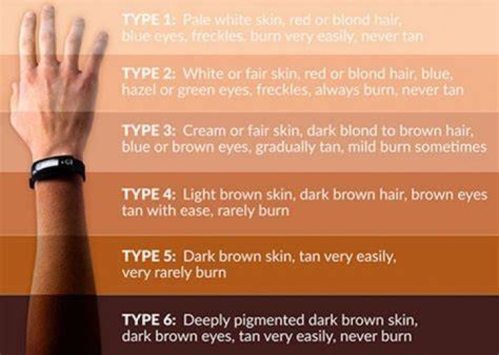 Why does my skin tan so easily?
