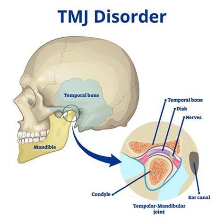 Why does my TMJ hurt more at night?