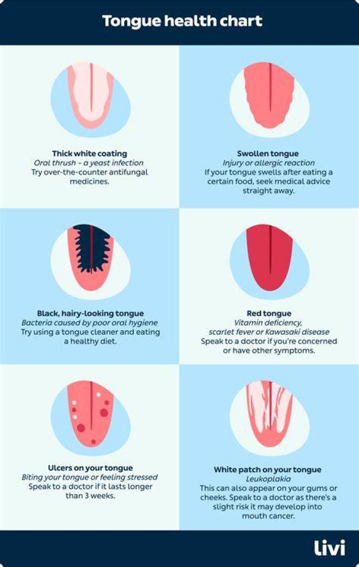 Why does the tongue swell when dying?
