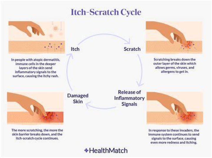 Why does your skin turn white when you scratch it?