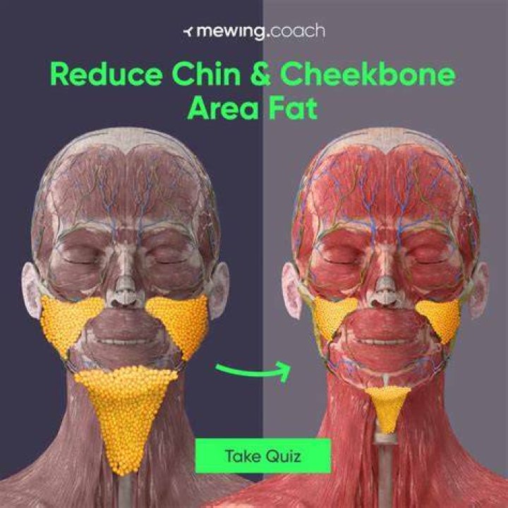 Why is my cheek fat?