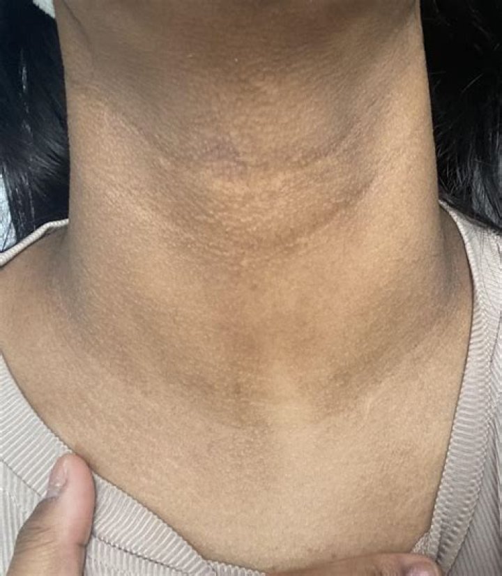 Why is my neck dirty?