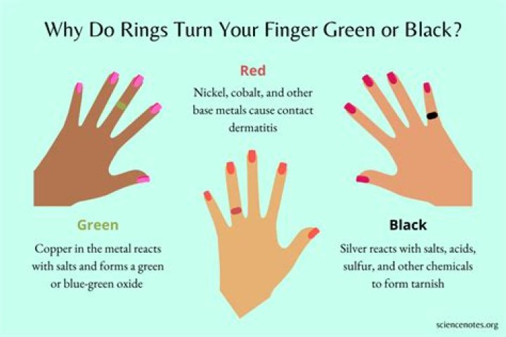Why is my real gold ring turning my finger green?