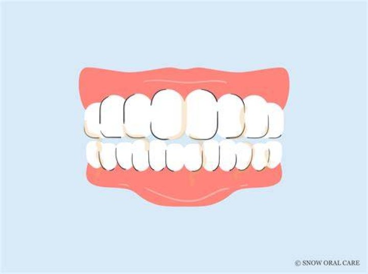 Why is my spit yellow when I brush my teeth?