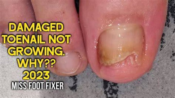 Why is my toenail green?