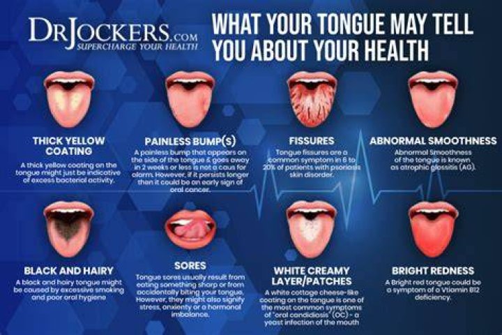 Why is my tongue bigger?