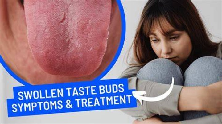 Why is one of my tastebuds white?