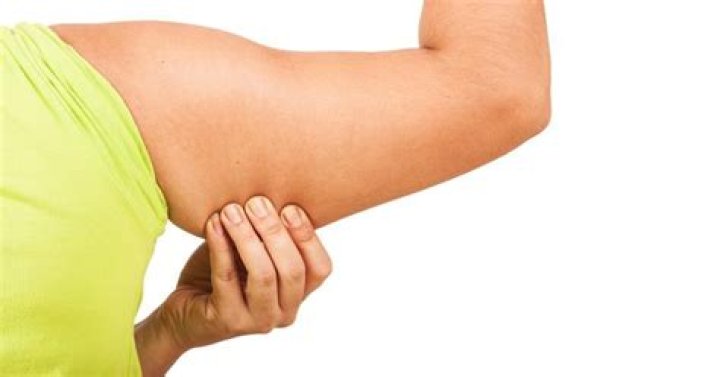Why won't my arms get thinner?