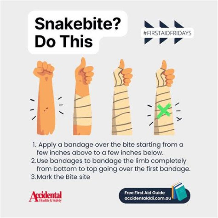 Will a snake bite you if you step on it?