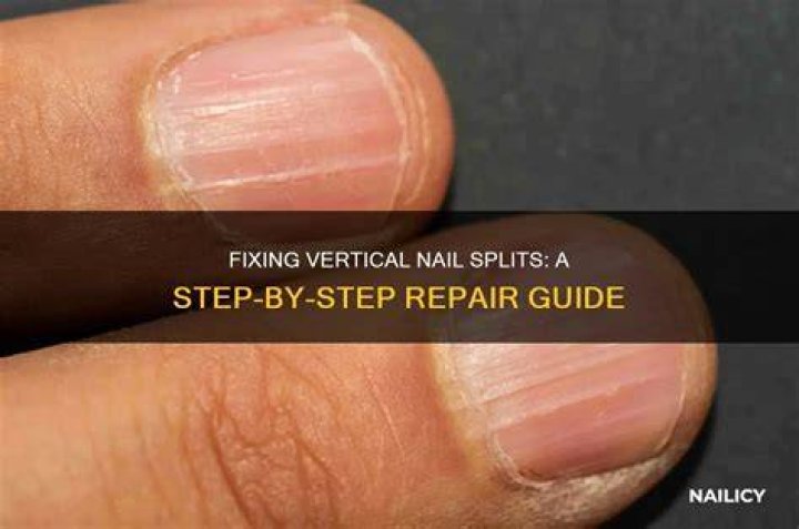 Will a split nail repair itself?