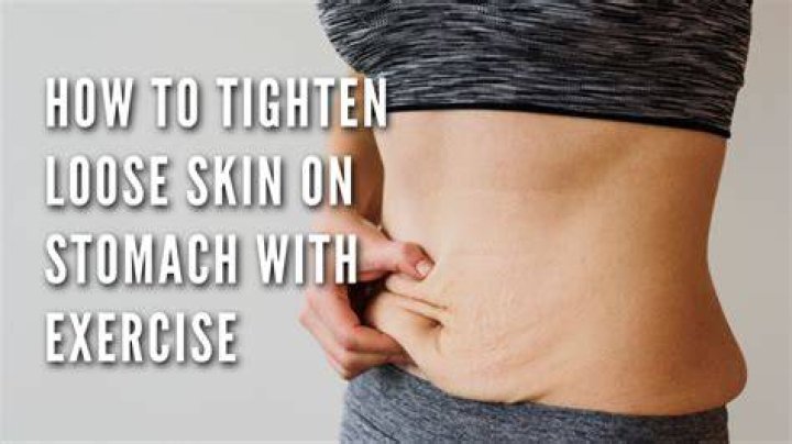 Will ab exercises tighten loose skin?