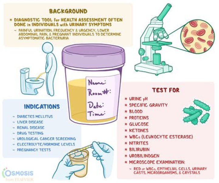 Will kombucha show up on urine test?
