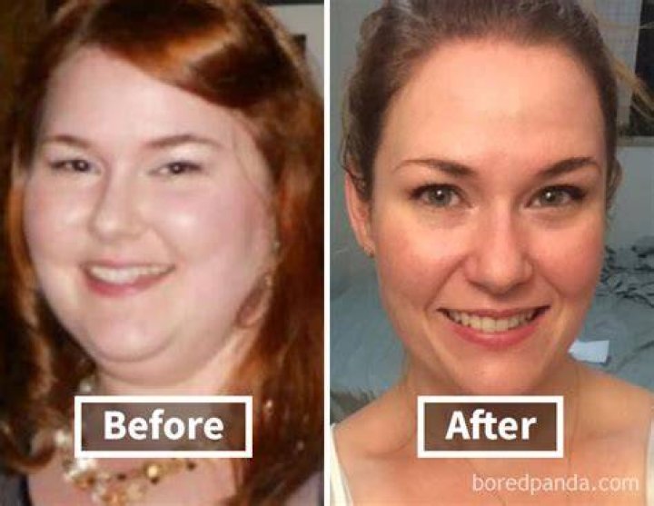 Will my face look prettier if I lose weight?